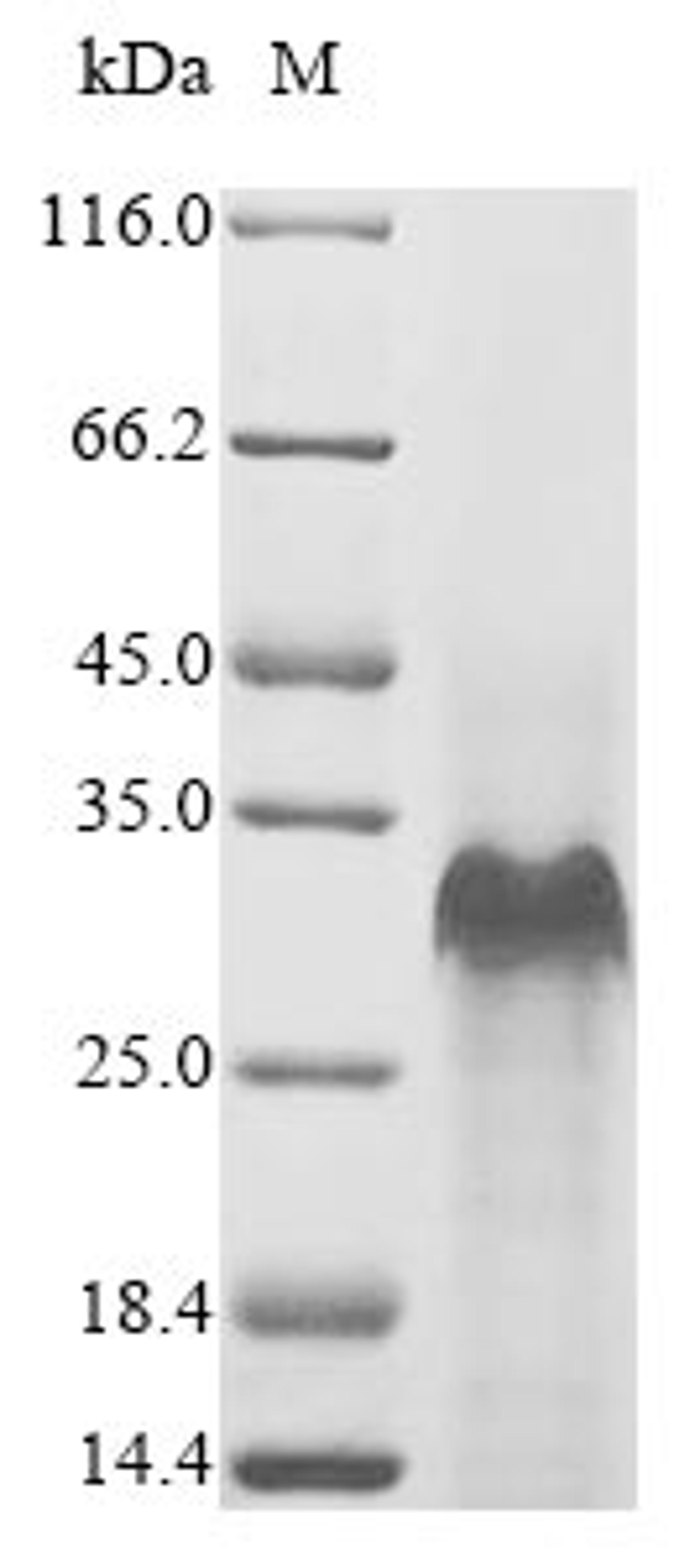 (Tris-Glycine gel) Discontinuous SDS-PAGE (reduced) with 5% enrichment gel and 15% separation gel.