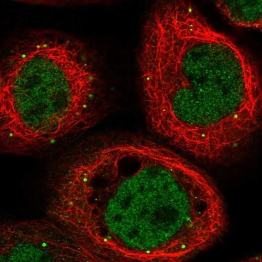 Immunocytochemistry/Immunofluorescence: ANKRD35 Antibody [NBP1-93924] - Staining of human cell line A-431 shows positivity in nucleus but not nucleoli & vesicles.