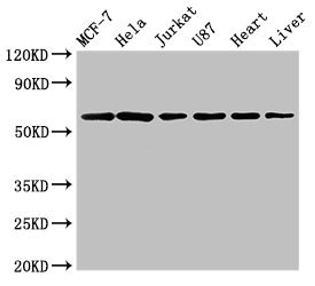 Western Blot. Positive WB detected in: MCF-7 whole cell lysate, Hela whole cell lysate, Jurkat whole cell lysate, U87 whole cell lysate, Rat heart tissue, Rat liver tissue. All lanes: SOCS7 antibody at 3µg/ml. Secondary. Goat polyclonal to rabbit IgG at 1/50000 dilution. Predicted band size: 63, 38 kDa. Observed band size: 63 kDa