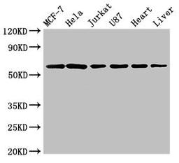 Western Blot. Positive WB detected in: MCF-7 whole cell lysate, Hela whole cell lysate, Jurkat whole cell lysate, U87 whole cell lysate, Rat heart tissue, Rat liver tissue. All lanes: SOCS7 antibody at 3µg/ml. Secondary. Goat polyclonal to rabbit IgG at 1/50000 dilution. Predicted band size: 63, 38 kDa. Observed band size: 63 kDa