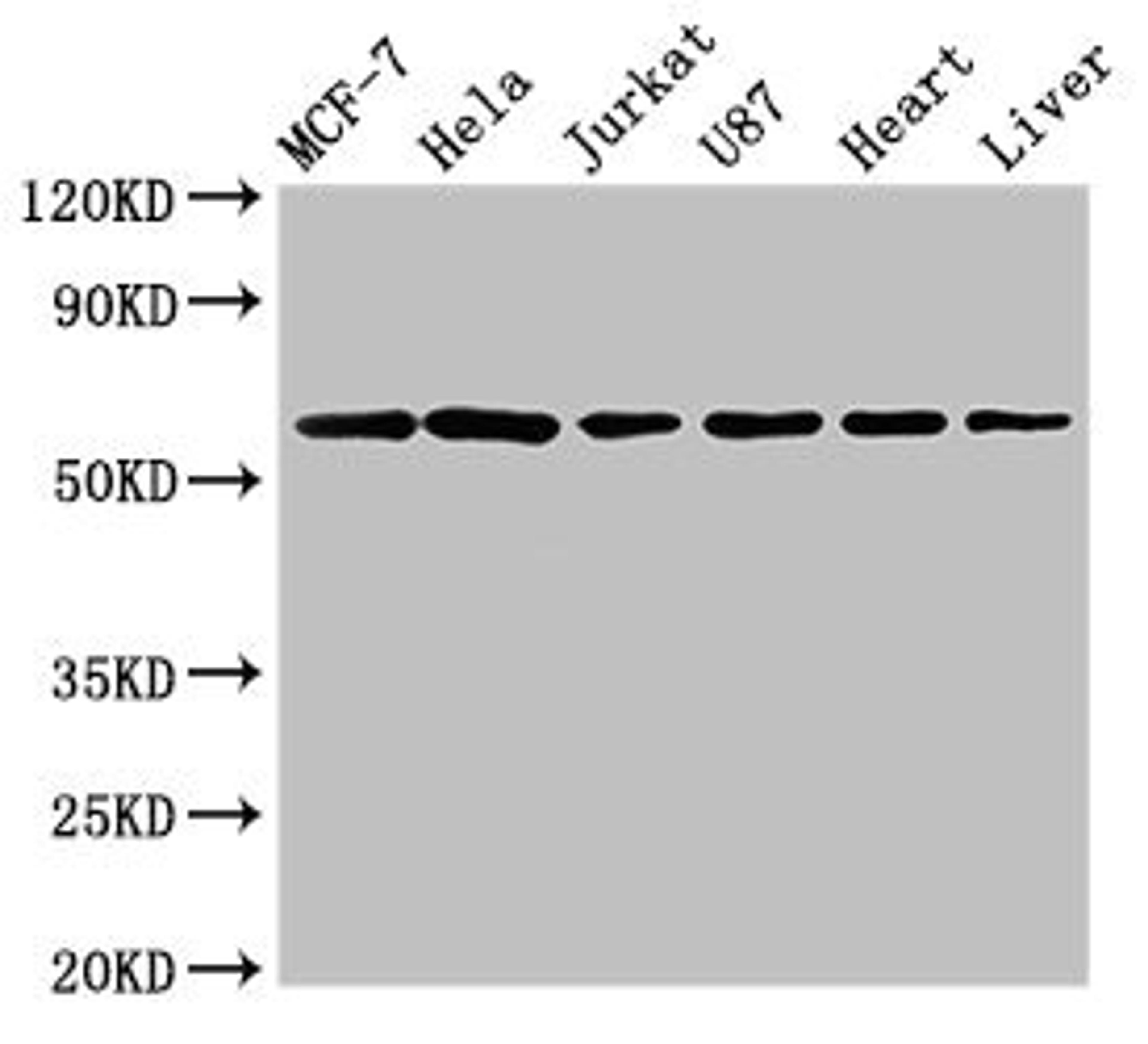 Western Blot. Positive WB detected in: MCF-7 whole cell lysate, Hela whole cell lysate, Jurkat whole cell lysate, U87 whole cell lysate, Rat heart tissue, Rat liver tissue. All lanes: SOCS7 antibody at 3µg/ml. Secondary. Goat polyclonal to rabbit IgG at 1/50000 dilution. Predicted band size: 63, 38 kDa. Observed band size: 63 kDa