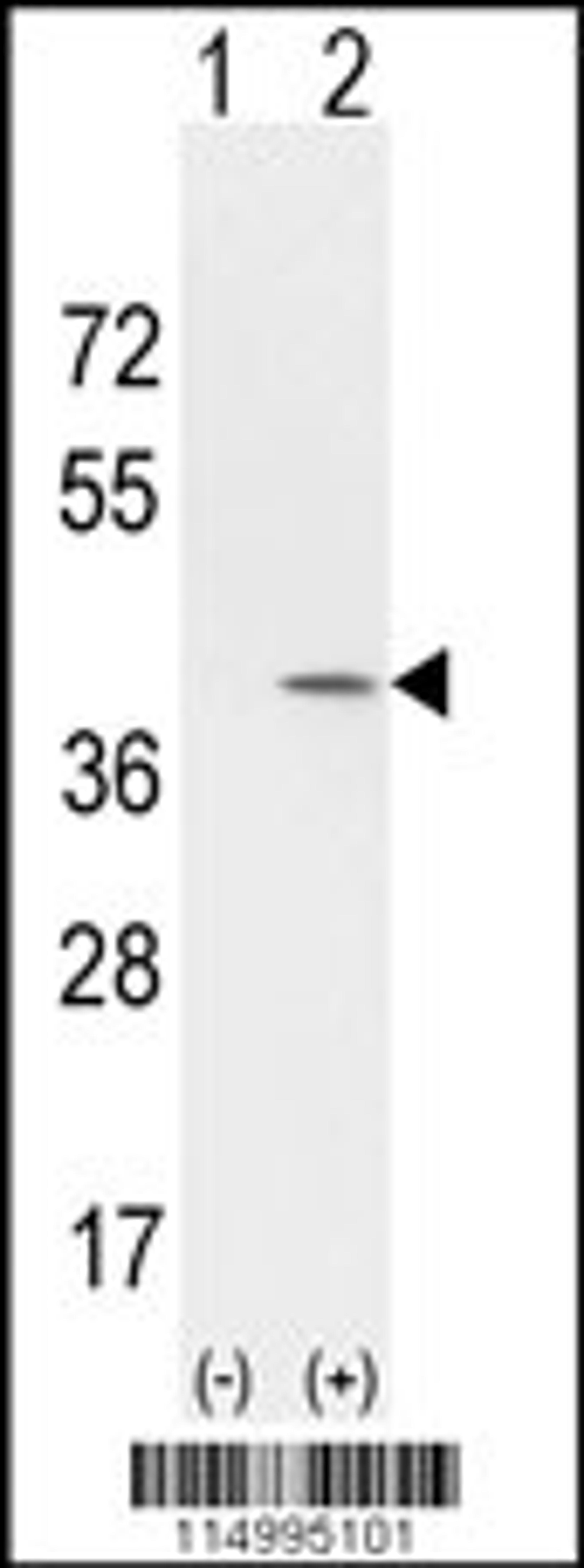 Western Blot in 293 cell lysates (2 ug/lane) either nontransfected (Lane 1) or transiently transfected with the CCND1 gene (Lane 2).