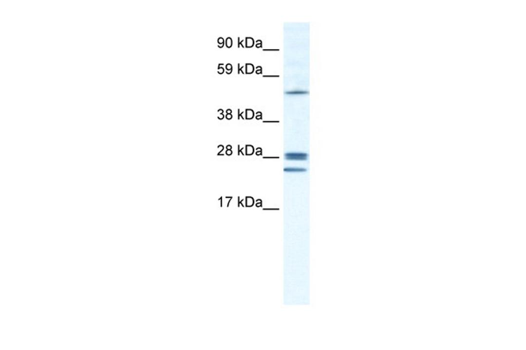 Antibody used in WB on Human Lung at 1.25 ug/ml.