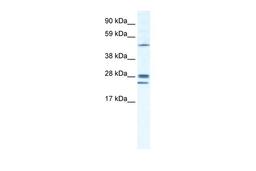 Antibody used in WB on Human Lung at 1.25 ug/ml.