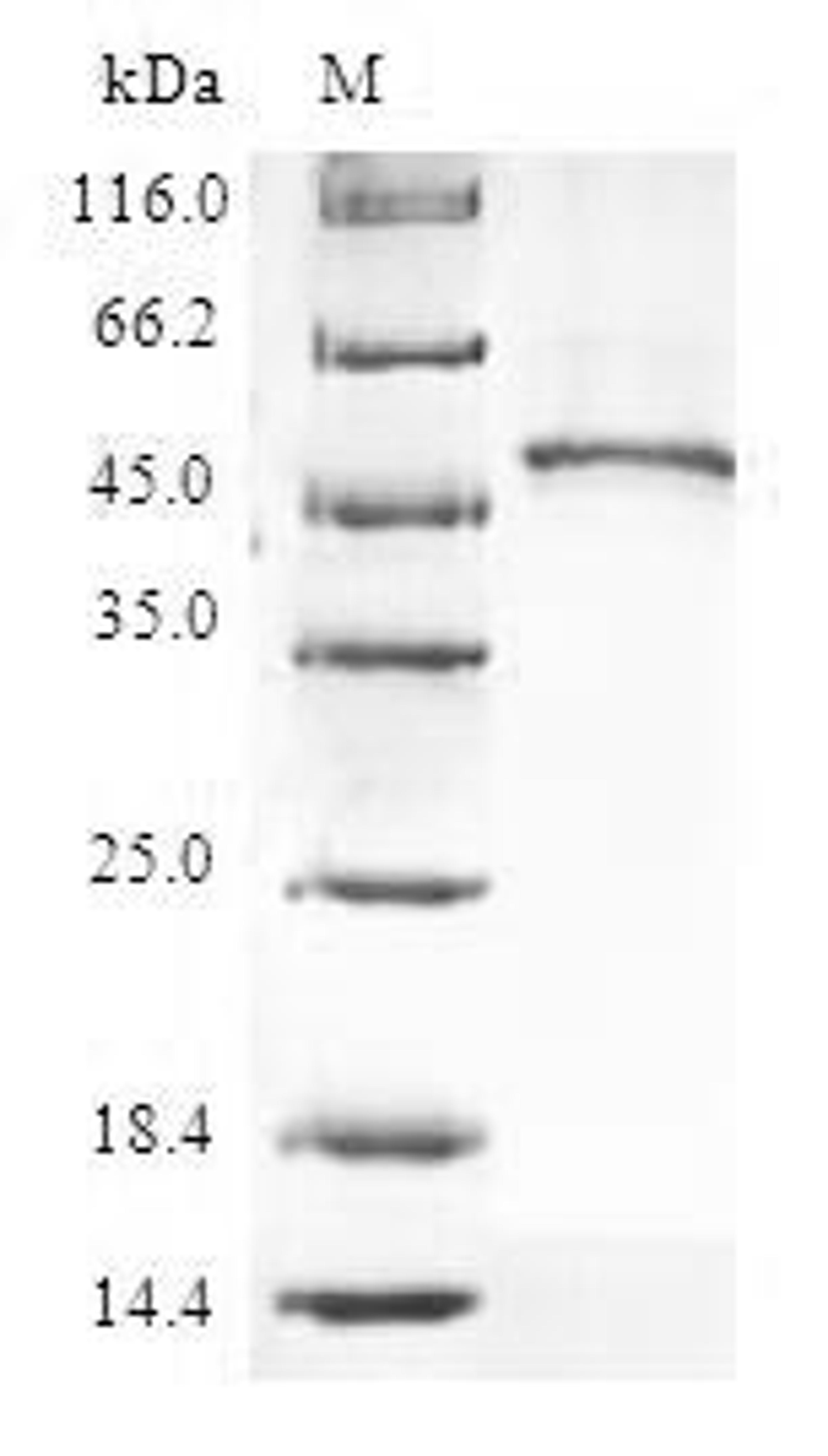 (Tris-Glycine gel) Discontinuous SDS-PAGE (reduced) with 5% enrichment gel and 15% separation gel.