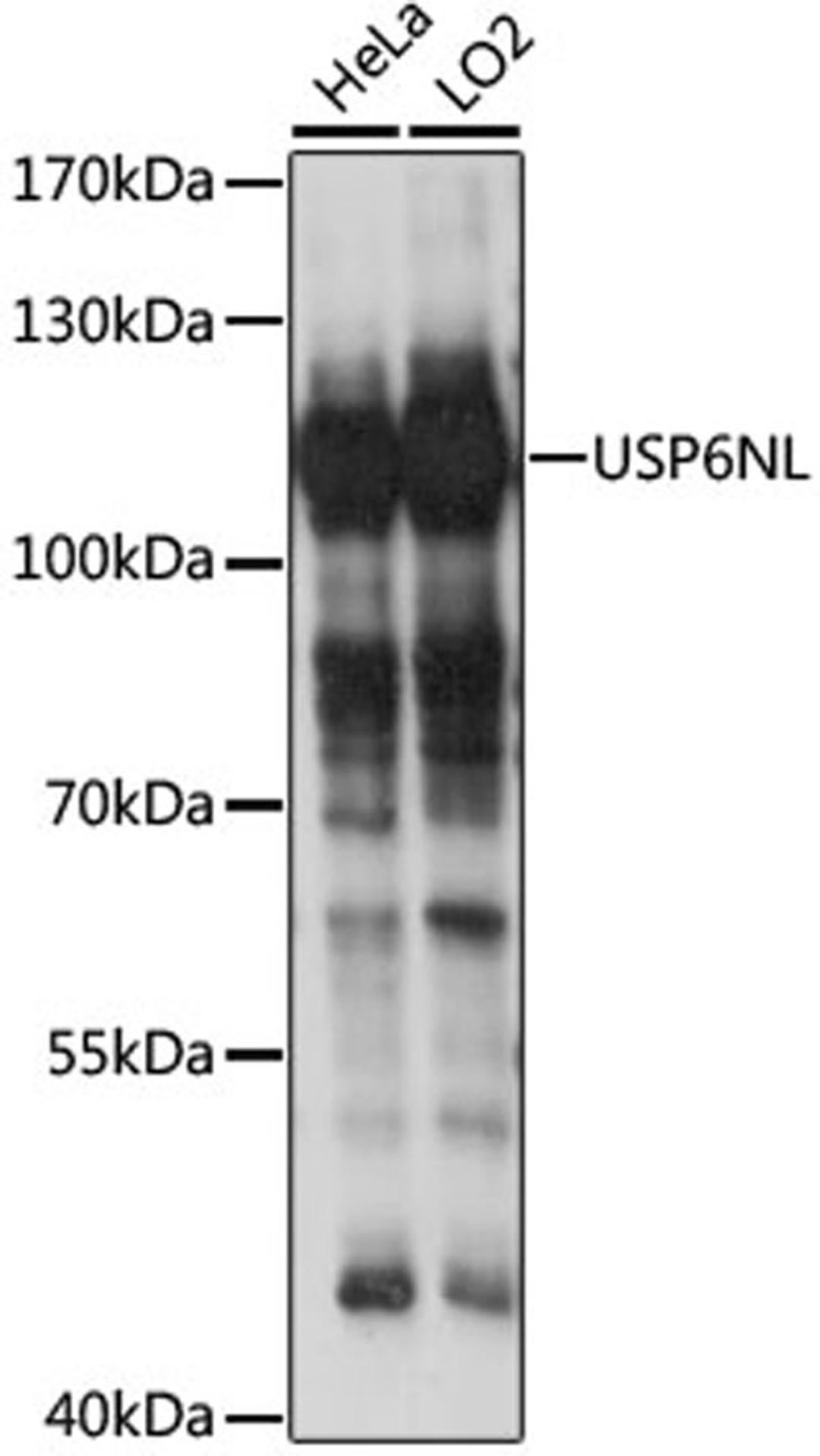 Western blot - USP6NL antibody (A15763)