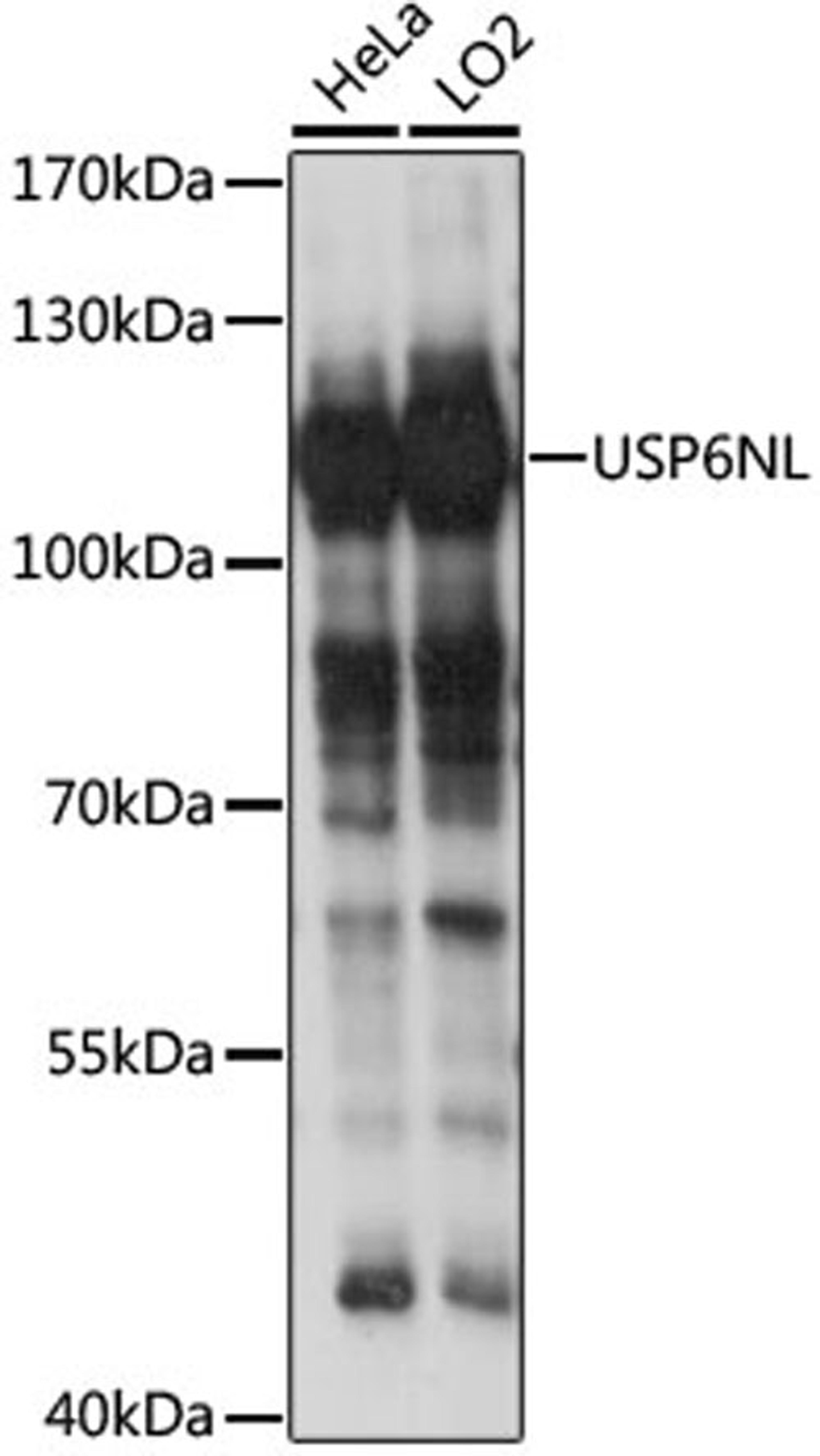 Western blot - USP6NL antibody (A15763)