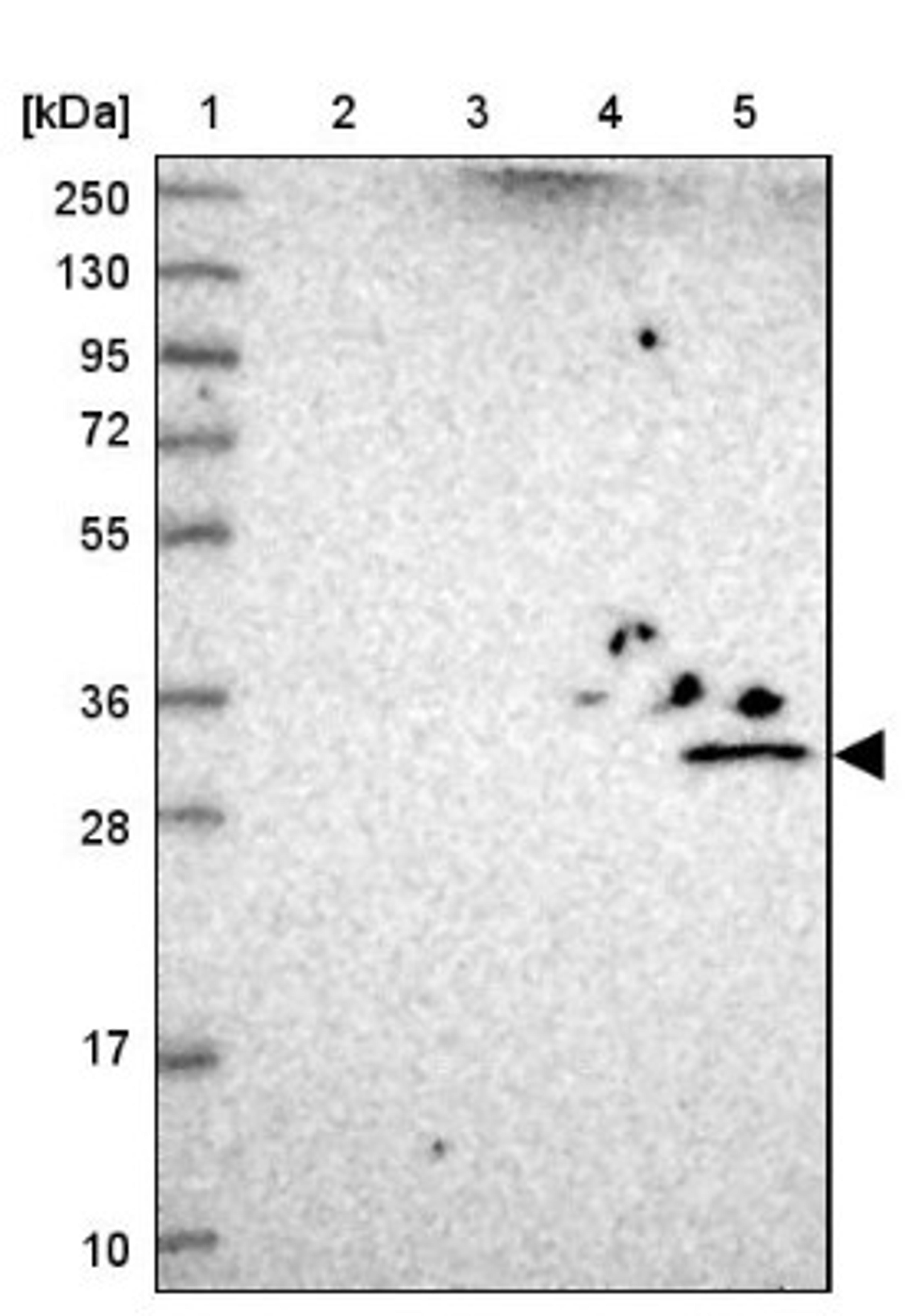 Western Blot: UTP23 Antibody [NBP1-92568] - Lane 1: Marker [kDa] 250, 130, 95, 72, 55, 36, 28, 17, 10<br/>Lane 2: Human cell line RT-4<br/>Lane 3: Human cell line U-251MG sp<br/>Lane 4: Human plasma (IgG/HSA depleted)<br/>Lane 5: Human liver tissue