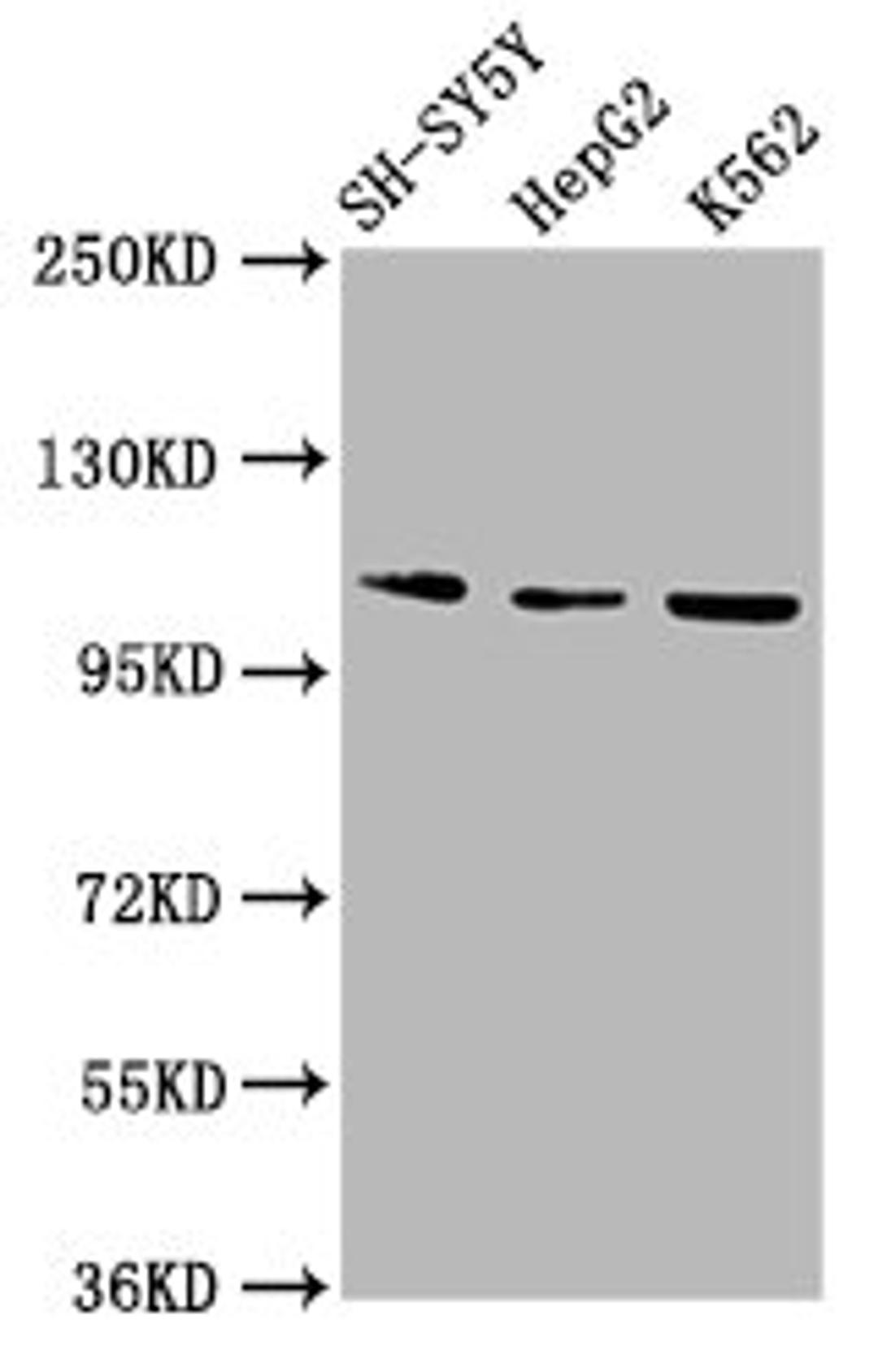 Western Blot. Positive WB detected in: SH-SY5Y whole cell lysate, HepG2 whole cell lysate, K562 whole cell lysate. All lanes: ULK2 antibody at 2.9µg/ml. Secondary. Goat polyclonal to rabbit IgG at 1/50000 dilution. Predicted band size: 113 kDa. Observed band size: 113 kDa