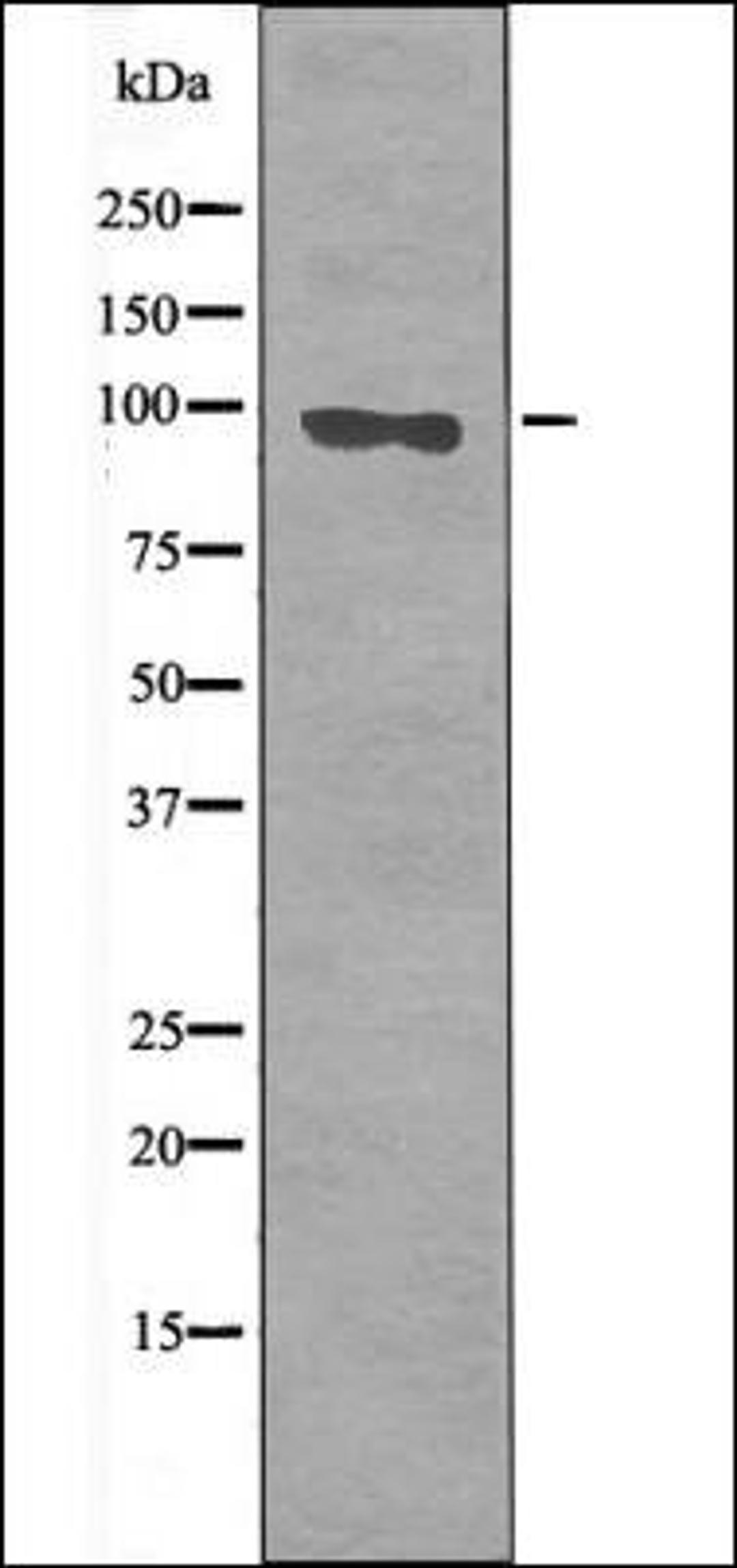 Western blot analysis of Sobital treated 293 whole cell lysates using FKHRL1 -Phospho-Ser644- antibody