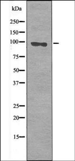 Western blot analysis of Sobital treated 293 whole cell lysates using FKHRL1 -Phospho-Ser644- antibody