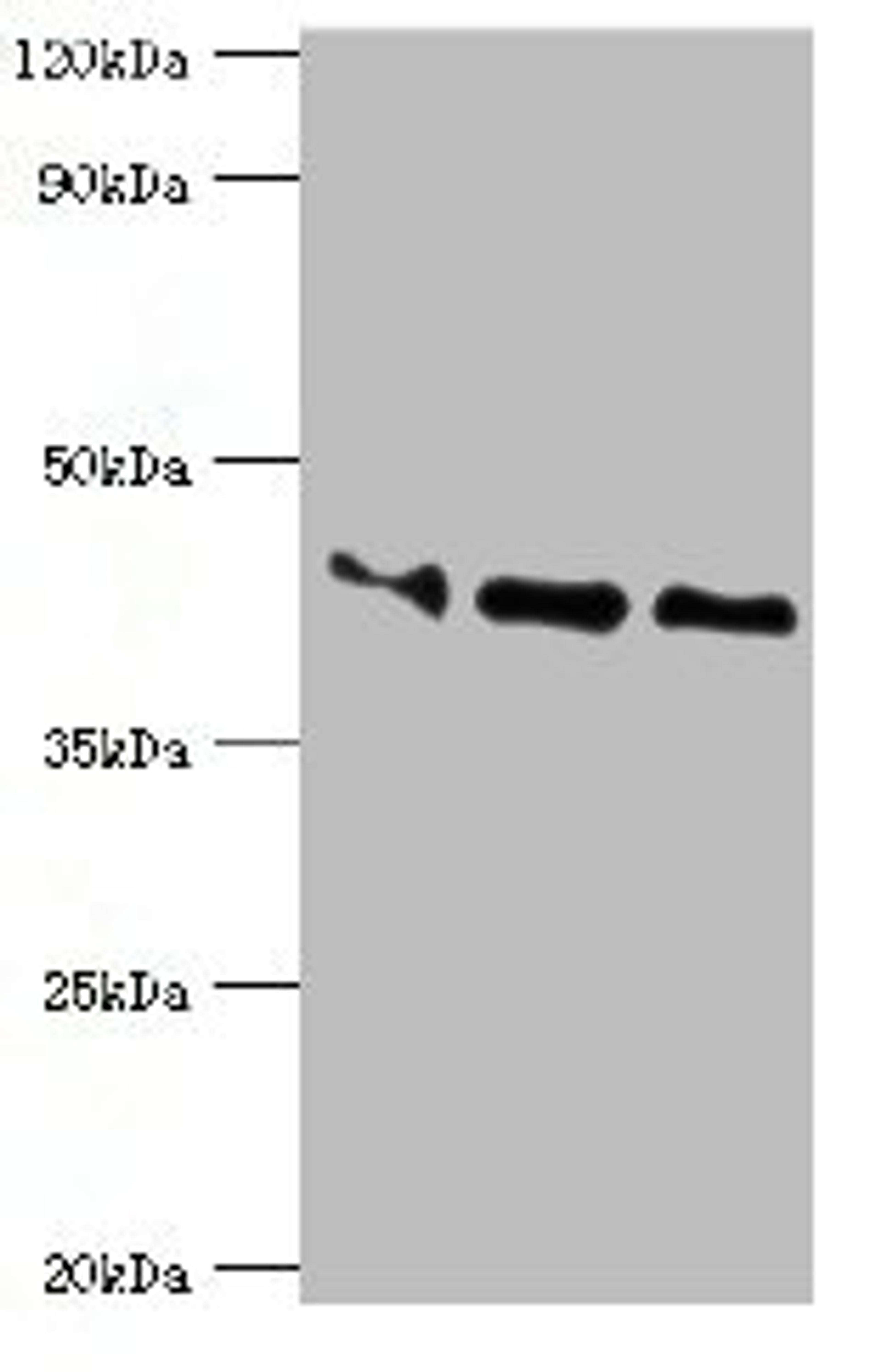 Western blot. All lanes: Apolipoprotein L1 antibody at 10ug/ml. Lane 1: A549 whole cell lysate. Lane 2: Hela whole cell lysate. Lane 3: HepG2 whole cell lysate. Secondary. Goat polyclonal to rabbit IgG at 1/10000 dilution. Predicted band size: 44, 46, 43 kDa. Observed band size: 44 kDa. 