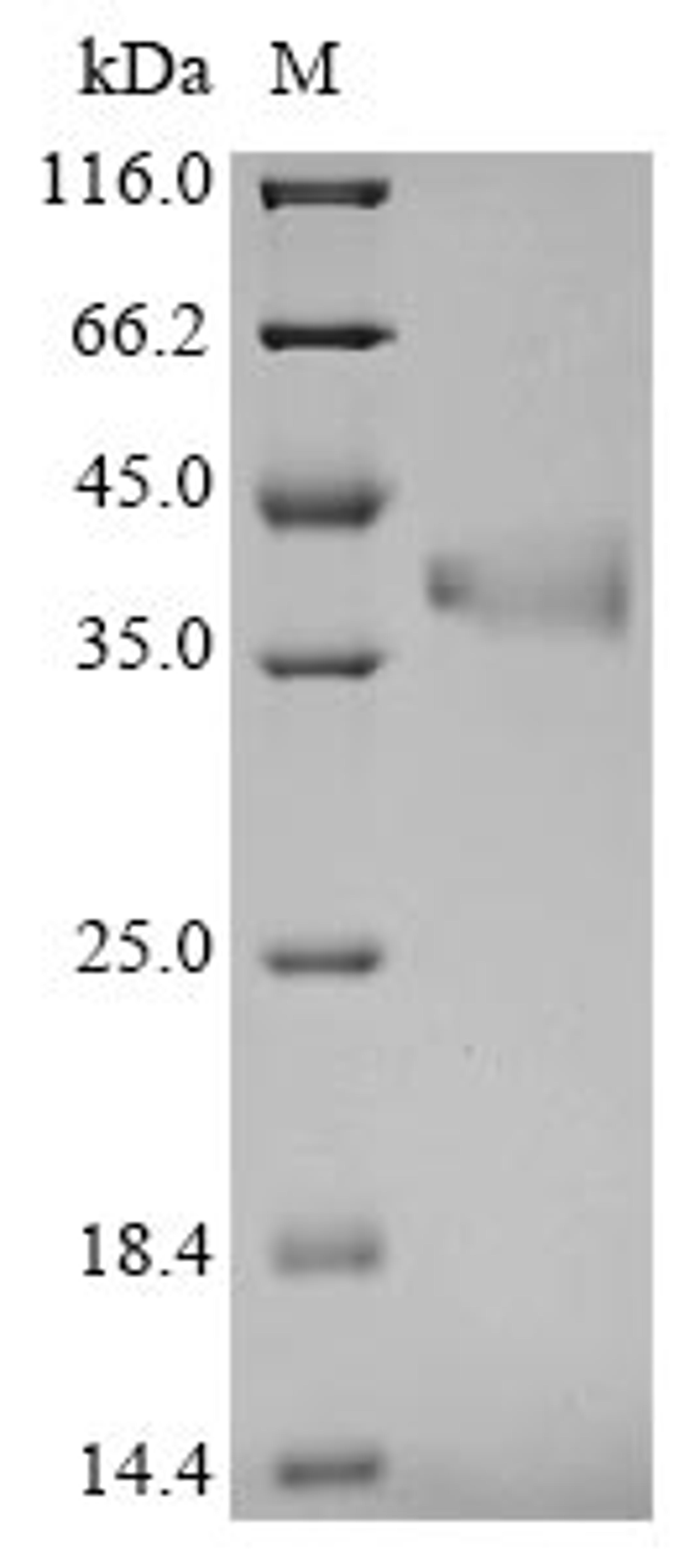 (Tris-Glycine gel) Discontinuous SDS-PAGE (reduced) with 5% enrichment gel and 15% separation gel.