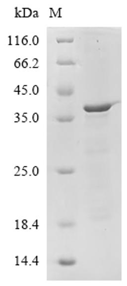 (Tris-Glycine gel) Discontinuous SDS-PAGE (reduced) with 5% enrichment gel and 15% separation gel.