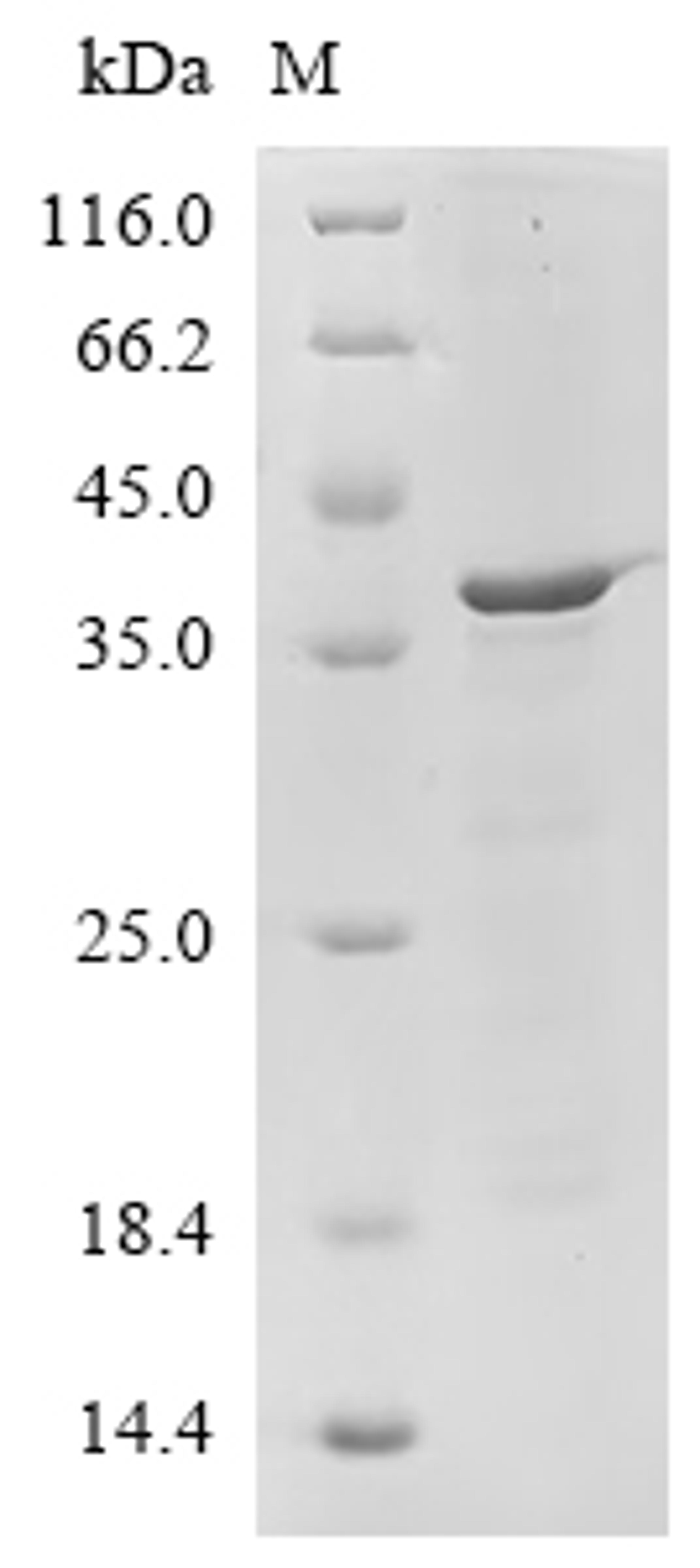 (Tris-Glycine gel) Discontinuous SDS-PAGE (reduced) with 5% enrichment gel and 15% separation gel.