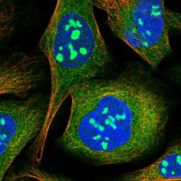 Immunocytochemistry/Immunofluorescence: ZNF397 Antibody [NBP1-82753] - Staining of human cell line U-2 OS shows positivity in nucleoli, plasma membrane, cytoplasm & cytoskeleton (microtubules).