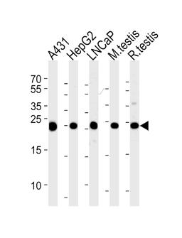 Western blot analysis of lysates from A431, HepG2, LNCaP cell line and mouse testis, rat testis tissue lysates (from left to right), using TPI1 Antibody at 1:1000 at each lane.