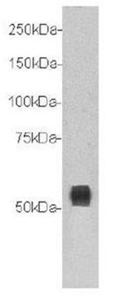 Western blot analysis of mouse Brain tissue using Transmembrane protein 132A antibody