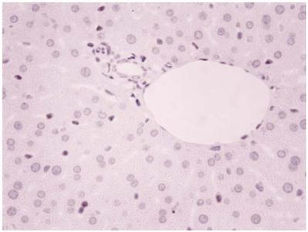 Immunohistochemistry-Paraffin: ZEB1 Antibody [NBP1-05987] - Analysis of ZEB1 in human liver and spleen tissues. Image courtesy of anonymous customer review.