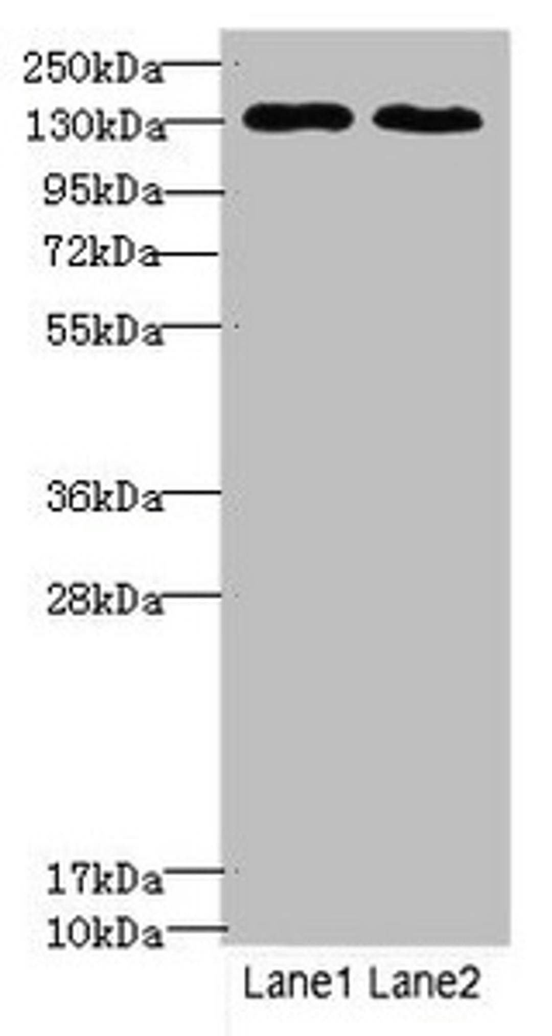 Western blot. All lanes: TPP2antibody at 3.42ug/ml. Lane 1: Hela whole cell lysate. Lane 2: HepG2 whole cell lysate. Secondary. Goat polyclonal to rabbit IgG at 1/10000 dilution. Predicted band size: 138 kDa. Observed band size: 138 kDa. 