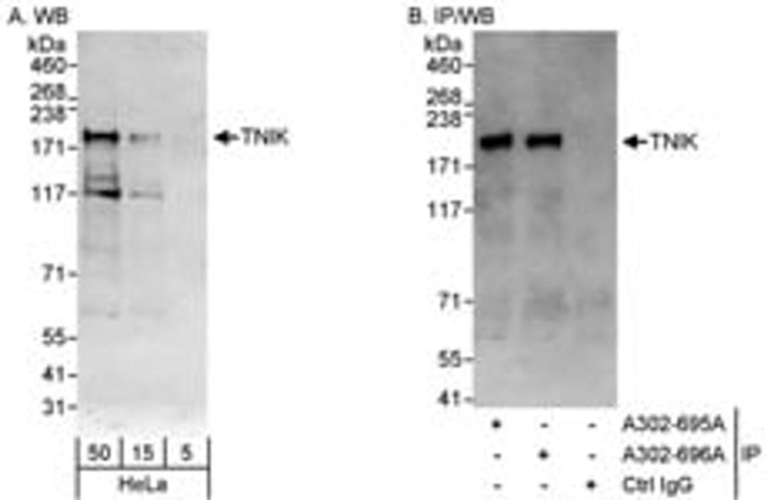 Detection of human TNIK by western blot and immunoprecipitation.