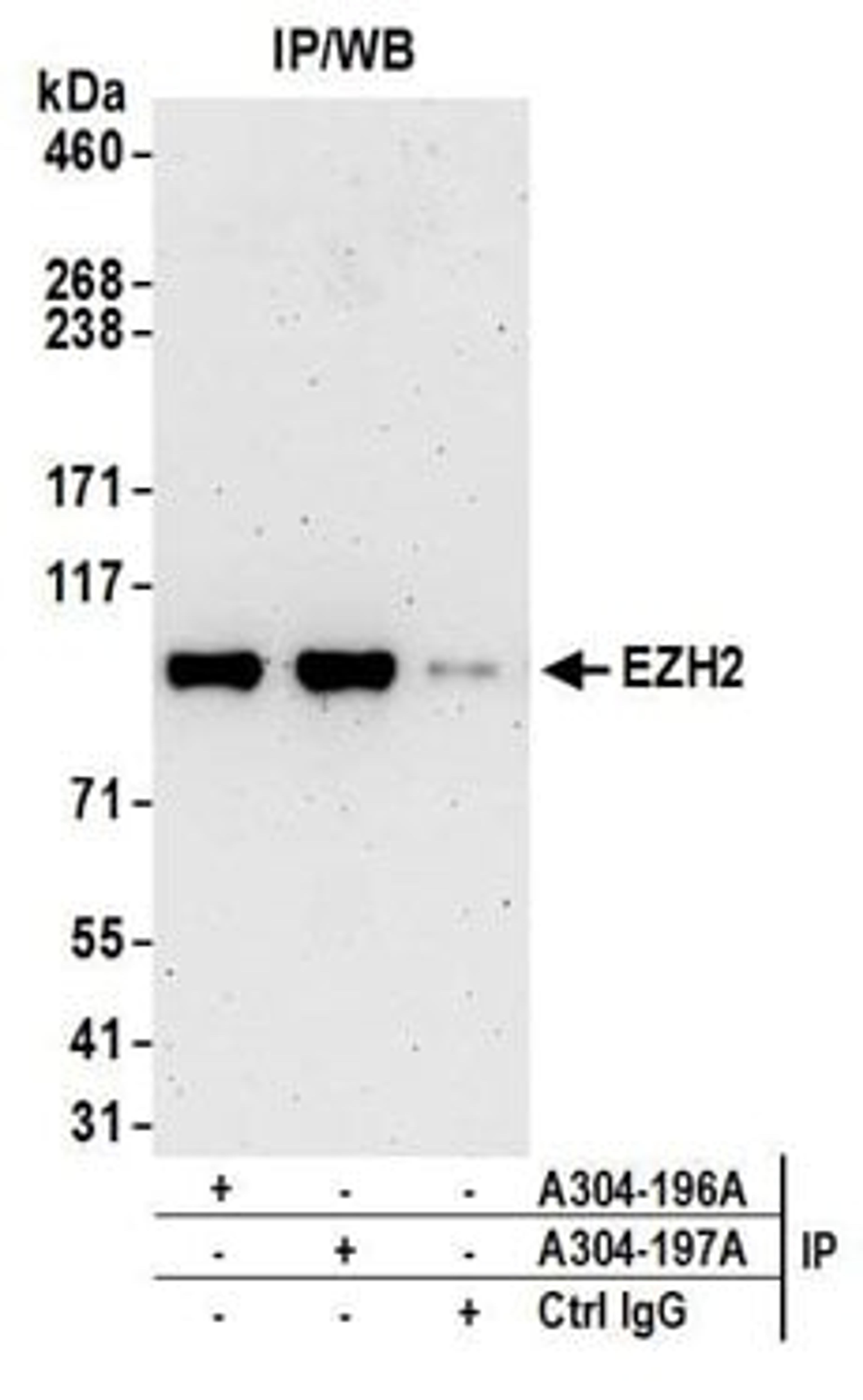 Detection of human EZH2 by western blot of immunoprecipitates.