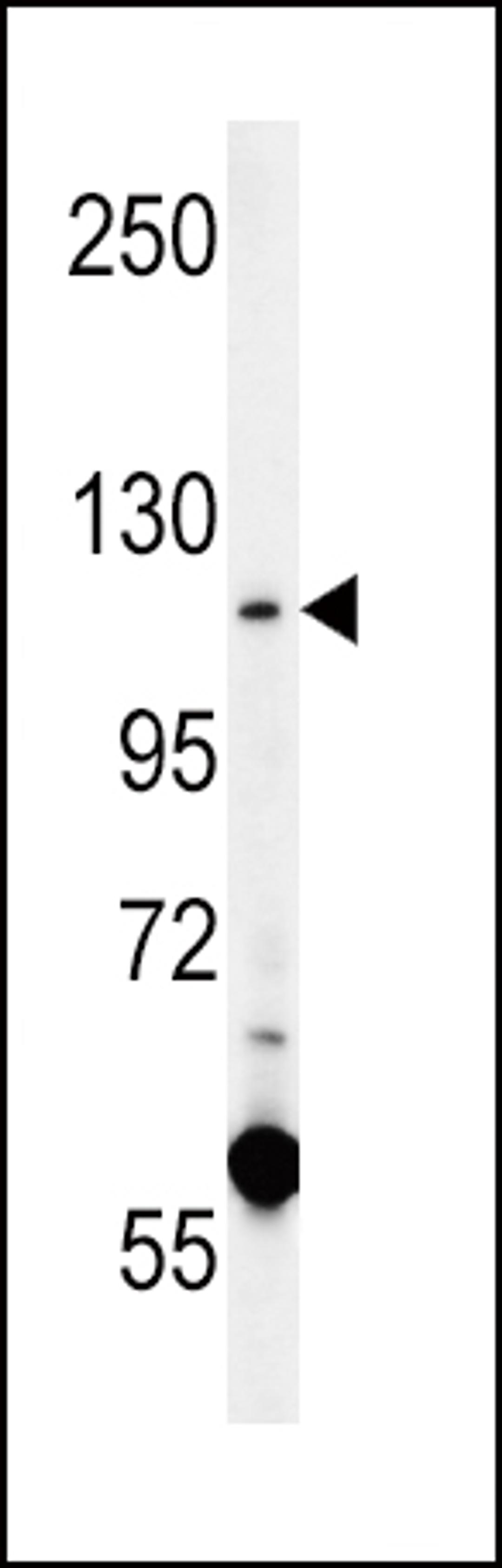 Western blot analysis in K562 cell line lysates (15ug/lane).