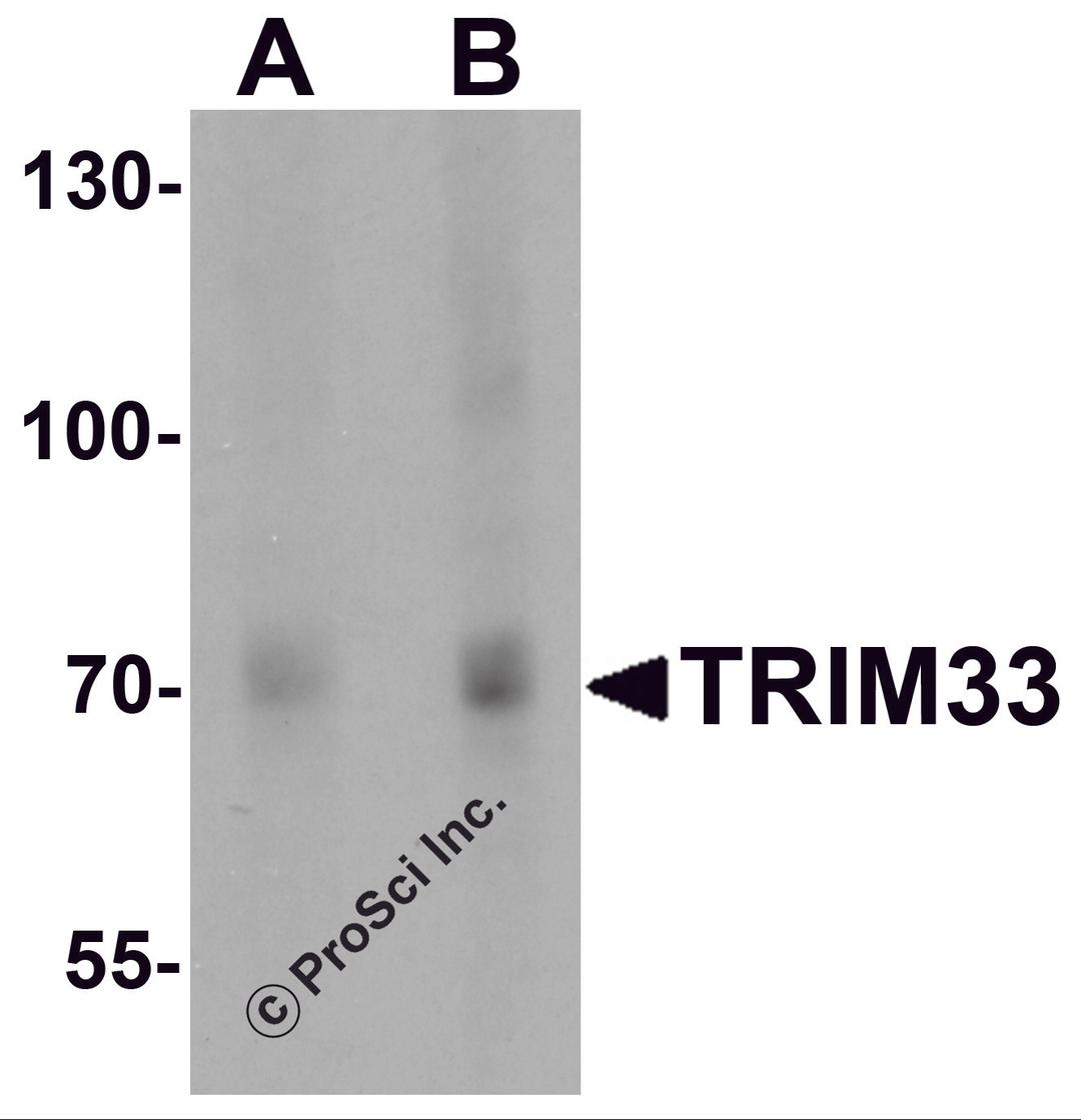 Western blot analysis of TRIM33 in human liver tissue lysate with TRIM33 antibody at (A) 1 and (B) 2 μg/mL.