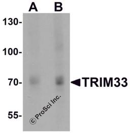 Western blot analysis of TRIM33 in human liver tissue lysate with TRIM33 antibody at (A) 1 and (B) 2 μg/mL.