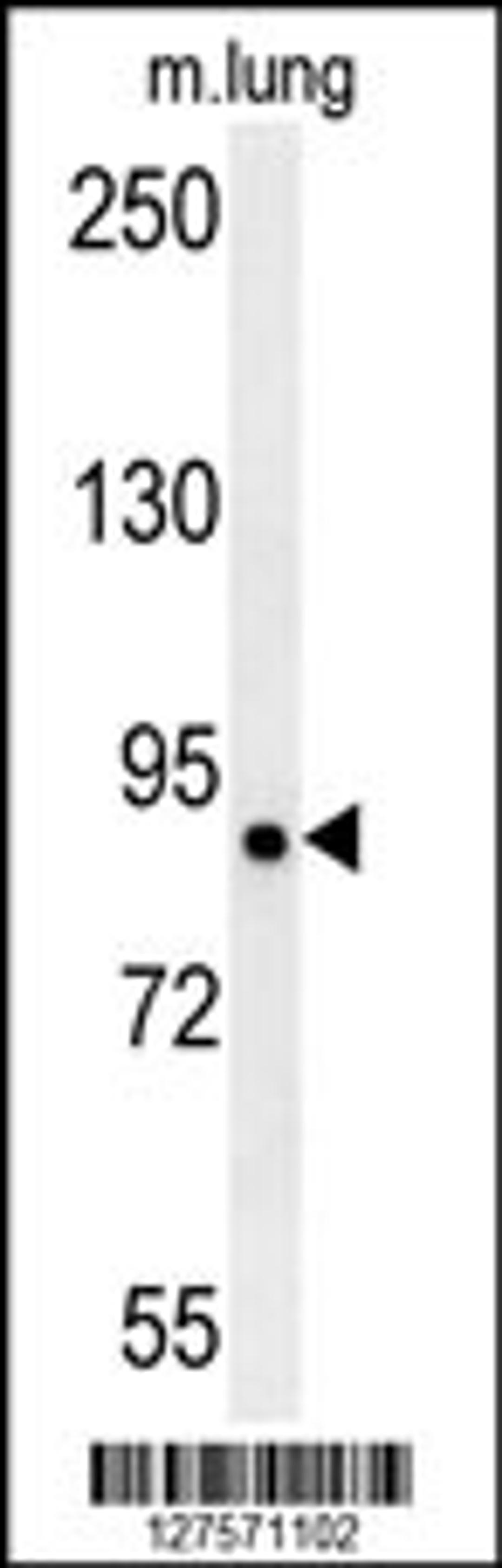 Western blot analysis in mouse lung tissue lysates (15ug/lane).This demonstrates the detected LRRC4B protein (arrow).