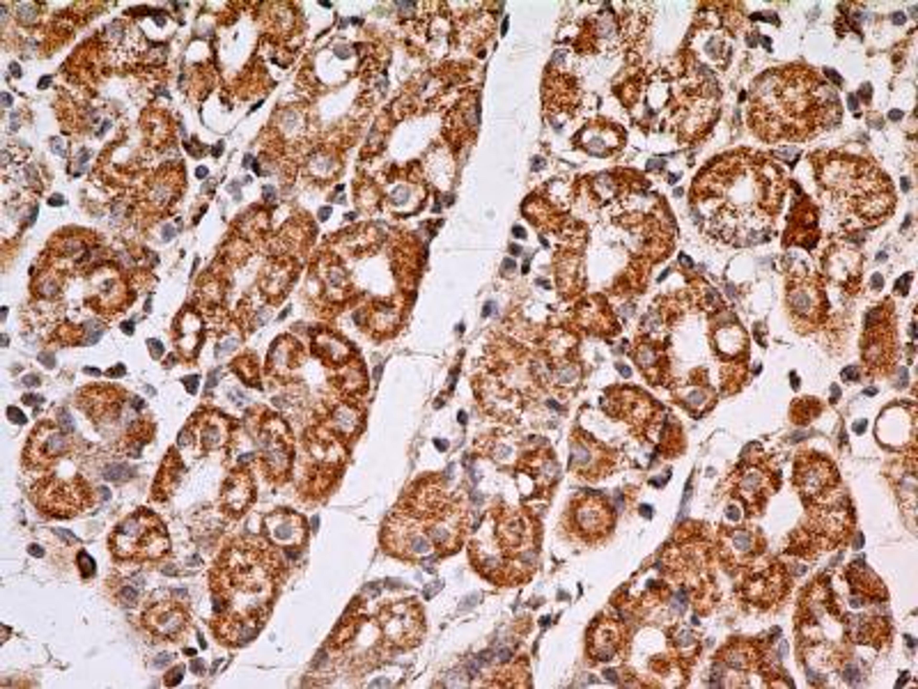 Immunohistochemistry-Paraffin: MUL1 Antibody (5H6.2D5) [NBP2-31361] - IHC-P analysis of MUL1 protein in a section of normal cardiac stomach from human using 5 ug/ml concentration of MUL1 antibody (clone 5H6.2D5). The cardiac glands showed distinct cytoplasmic staining, wherein, the parietal cells as well as the chief cells were found positive for MUL1.