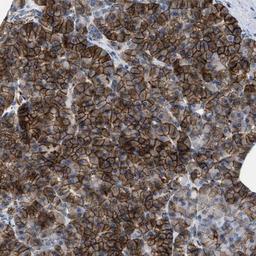 Immunohistochemistry-Paraffin: Kir3.4 Antibody [NBP1-88081] - Staining of human pancreas shows strong cytoplasmic and membranous positivity in exocrine glandular cells.