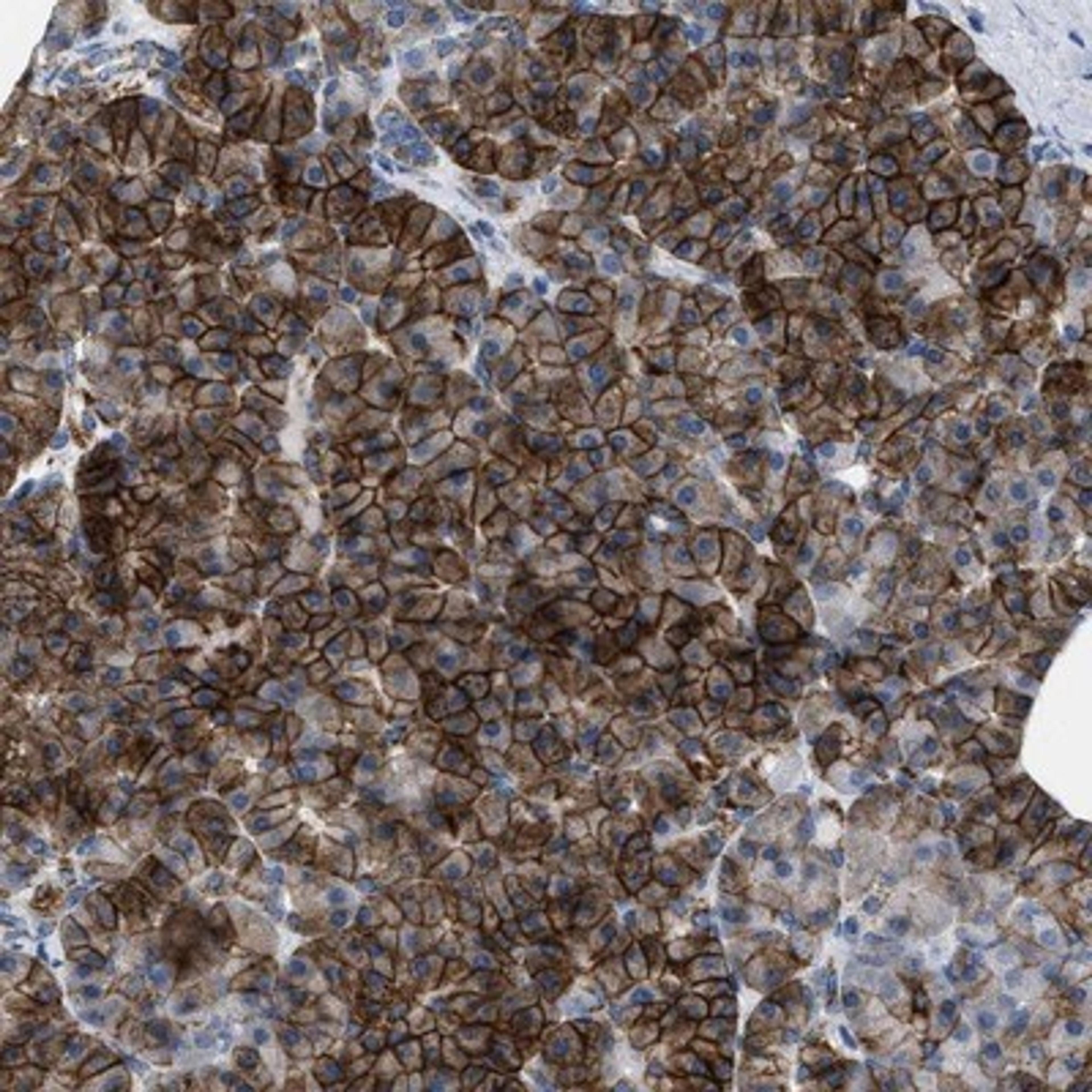 Immunohistochemistry-Paraffin: Kir3.4 Antibody [NBP1-88081] - Staining of human pancreas shows strong cytoplasmic and membranous positivity in exocrine glandular cells.