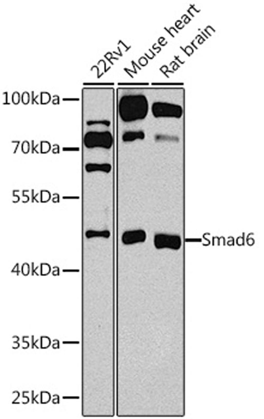 Western blot - Smad6 antibody (A0579)