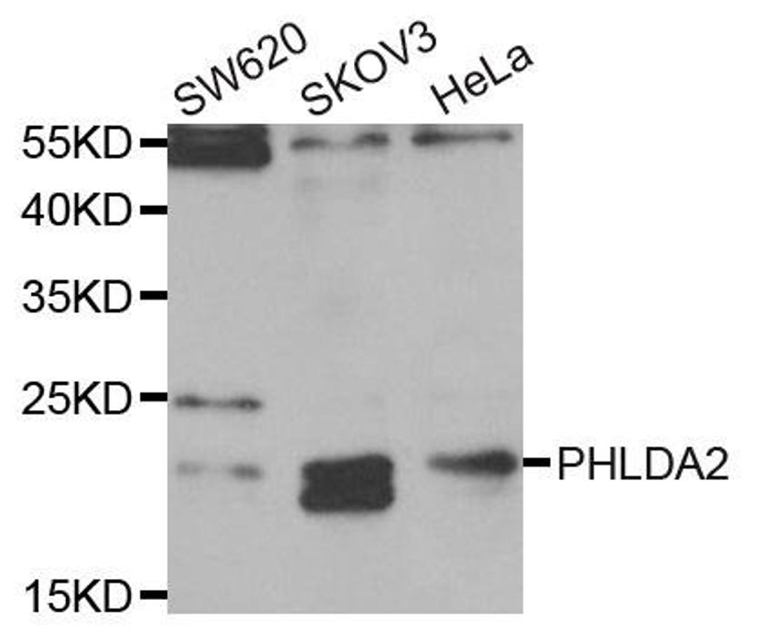 Western blot analysis of extracts of various cell lines using PHLDA2 antibody