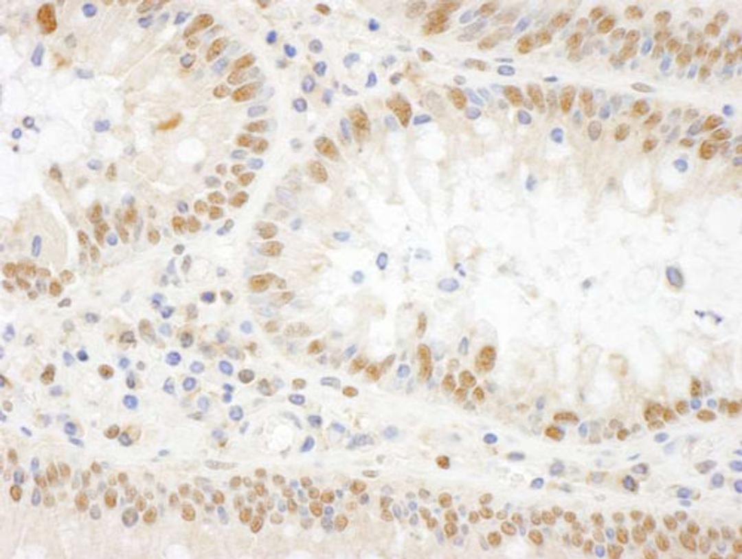 Detection of human BOP1 by IHC.