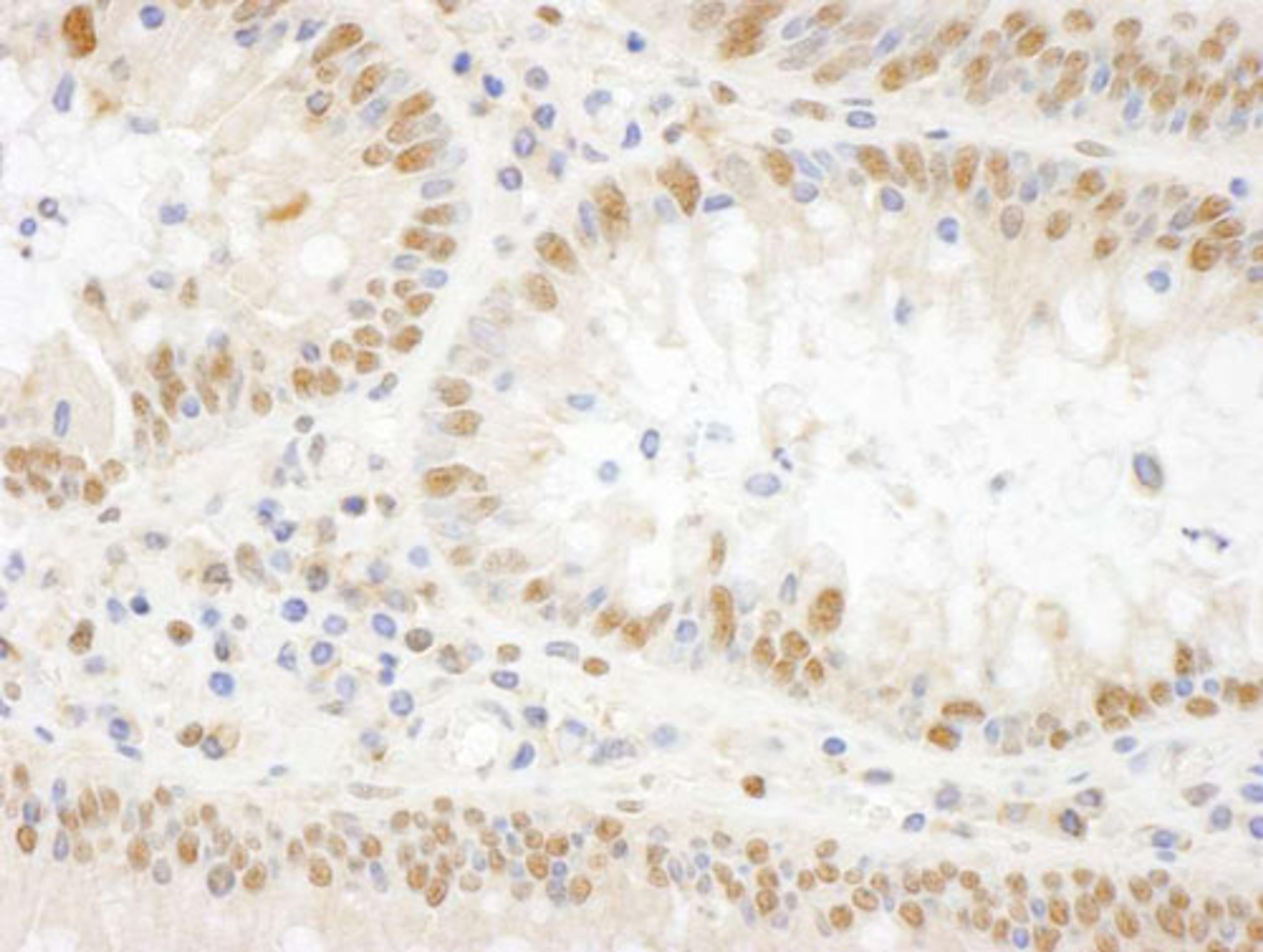 Detection of human BOP1 by IHC.