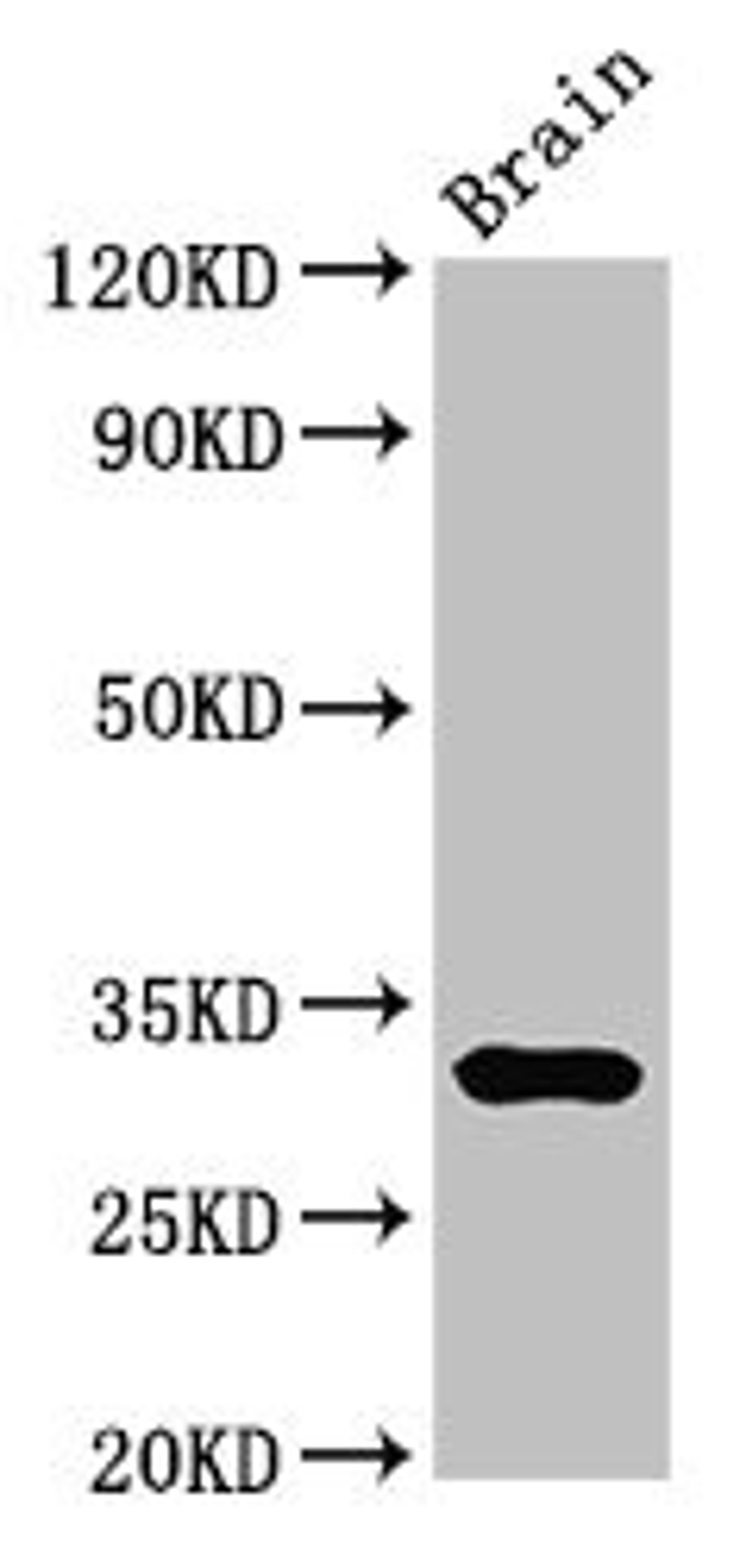 Western Blot. Positive WB detected in: Mouse brain tissue. All lanes: DNASE1 antibody at 3ug/ml. Secondary. Goat polyclonal to rabbit IgG at 1/50000 dilution. Predicted band size: 32, 20 kDa. Observed band size: 32 kDa.