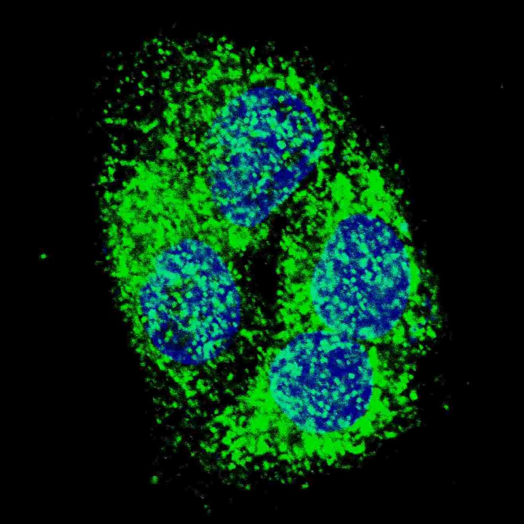 Fluorescent confocal image of HepG2 cells stained with BNIP3 (BH3 Domain Specific) antibody. HepG2 cells were fixed with 4% PFA (20 min), permeabilized with Triton X-100 (0.2%, 30 min). Cells were then incubated with BNIP3 (BH3 Domain Specific) primary an