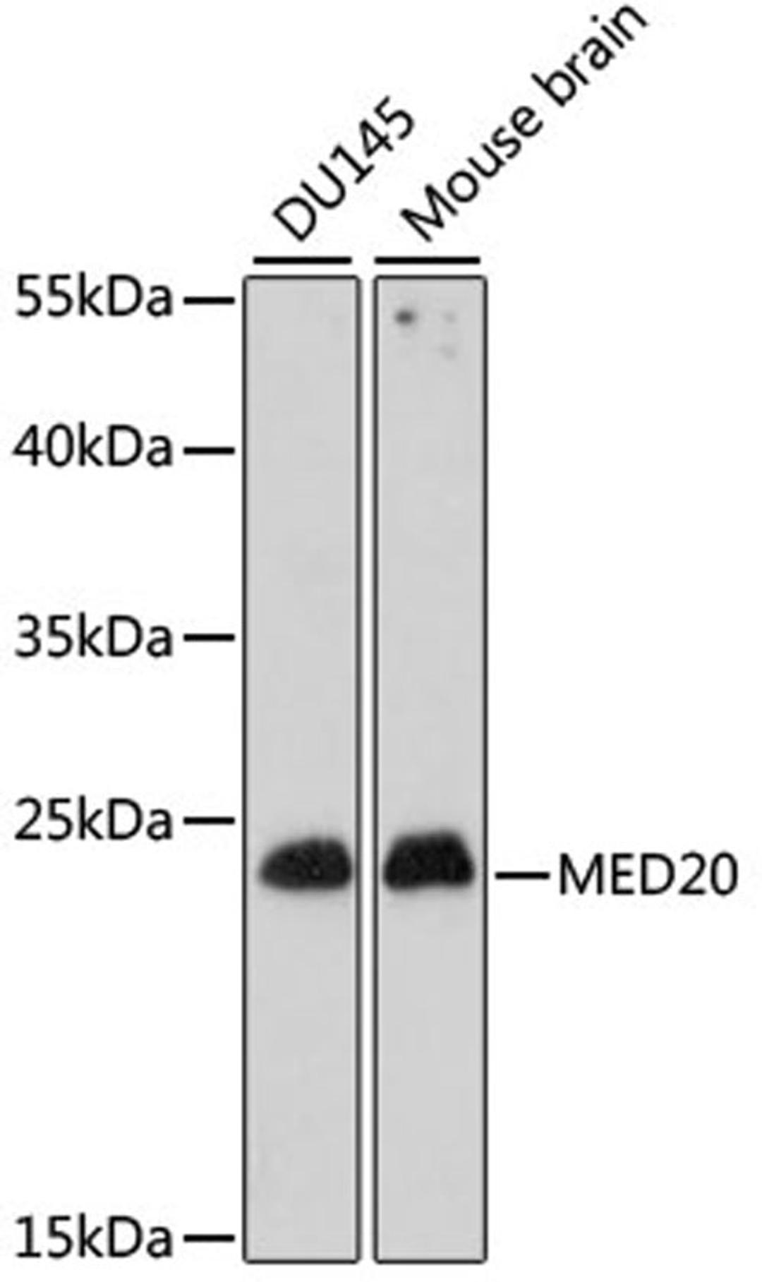 Western blot - MED20 antibody (A15757)