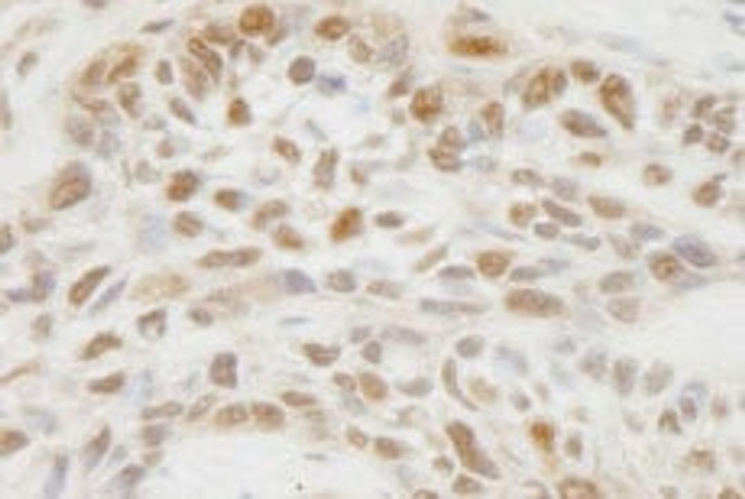 Detection of human JMJD1C by immunohistochemistry.