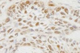 Detection of human JMJD1C by immunohistochemistry.