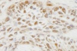 Detection of human JMJD1C by immunohistochemistry.