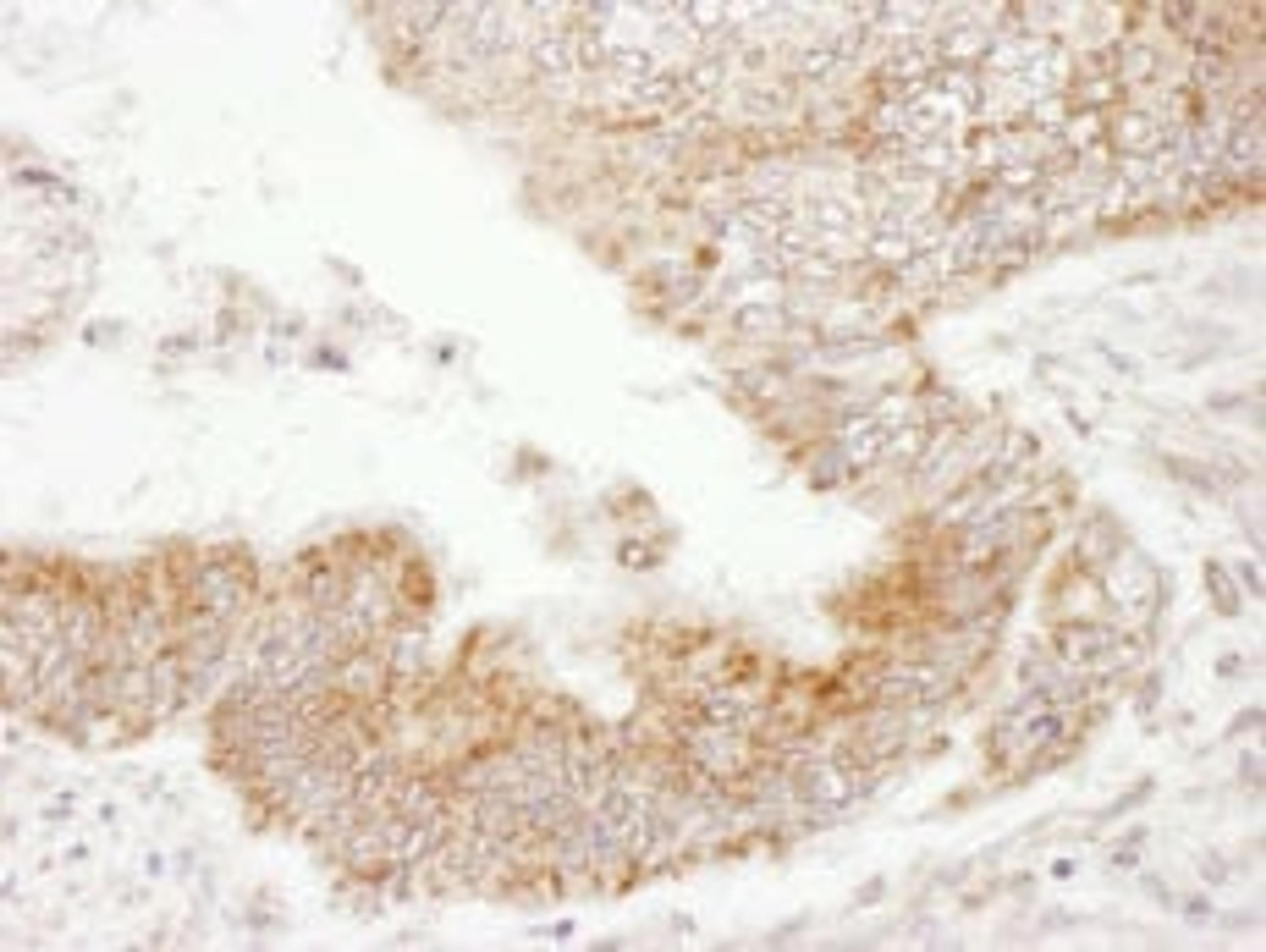 Detection of human PDZ-GEF1 by immunohistochemistry.