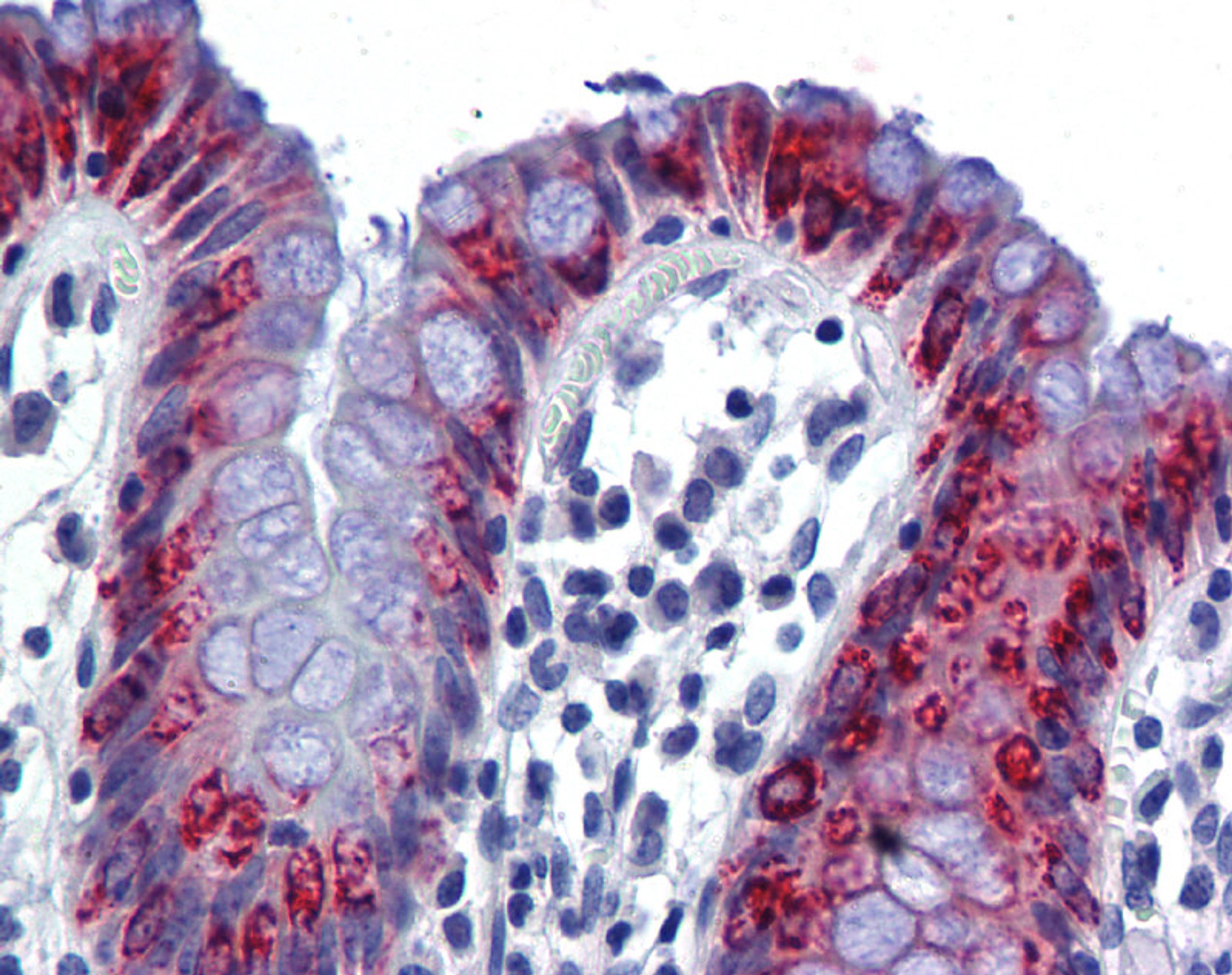 Antibody used in IHC on Human Col.