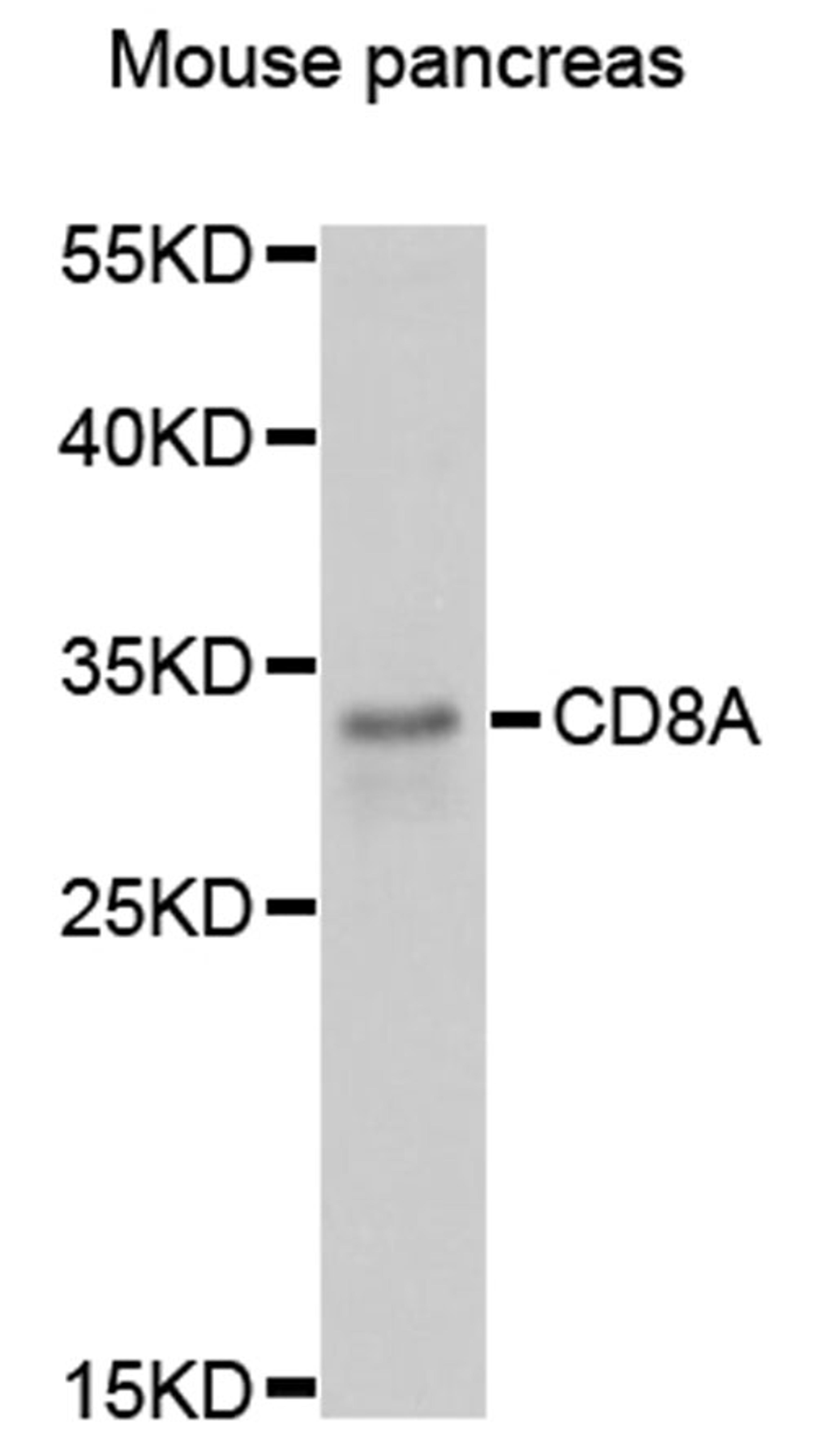 Western blot - CD8A antibody (A11856)