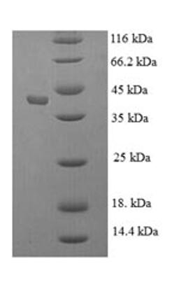 (Tris-Glycine gel) Discontinuous SDS-PAGE (reduced) with 5% enrichment gel and 15% separation gel.