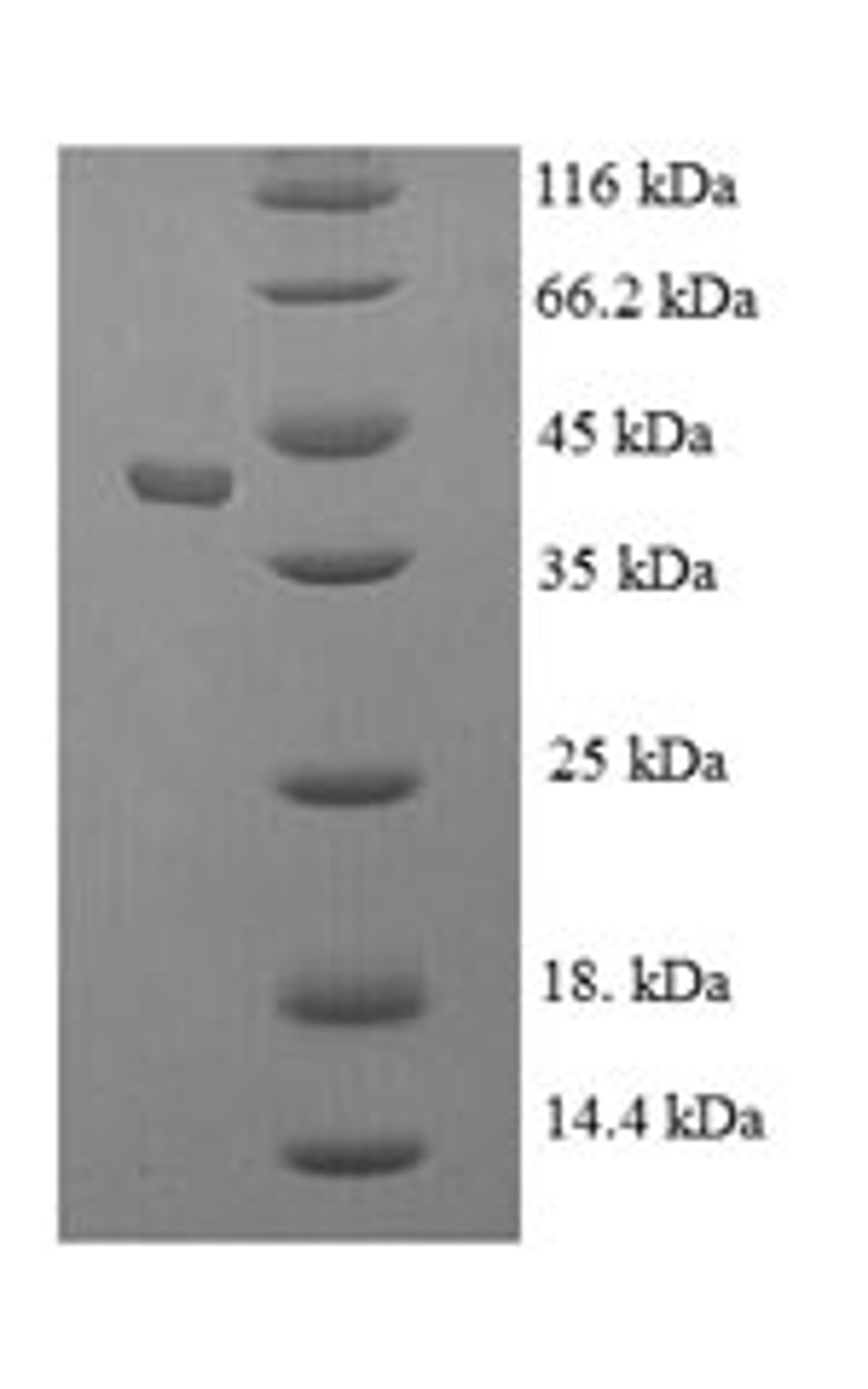 (Tris-Glycine gel) Discontinuous SDS-PAGE (reduced) with 5% enrichment gel and 15% separation gel.