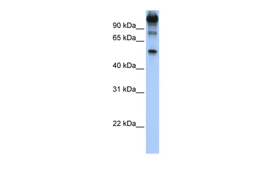 Antibody used in WB on Human HeLa at 1 ug/ml.