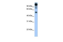 Antibody used in WB on Human HeLa at 1 ug/ml.